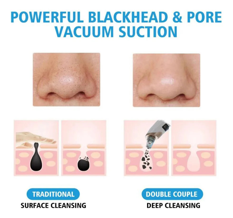 LIMPIADOR PUNTOS NEGROS